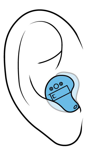 Illustration of an in-the-canal hearing aid.