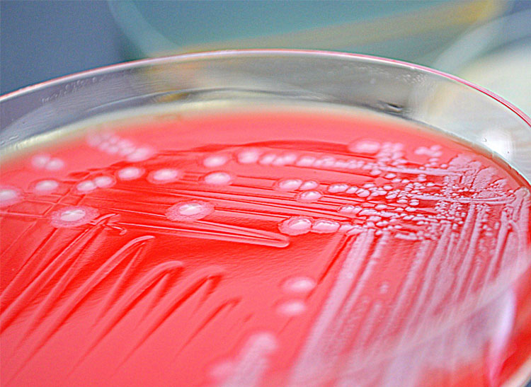 E. coli being grown in a petri dish.