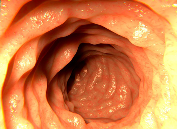 Colonoscopy Images Healthy Diet