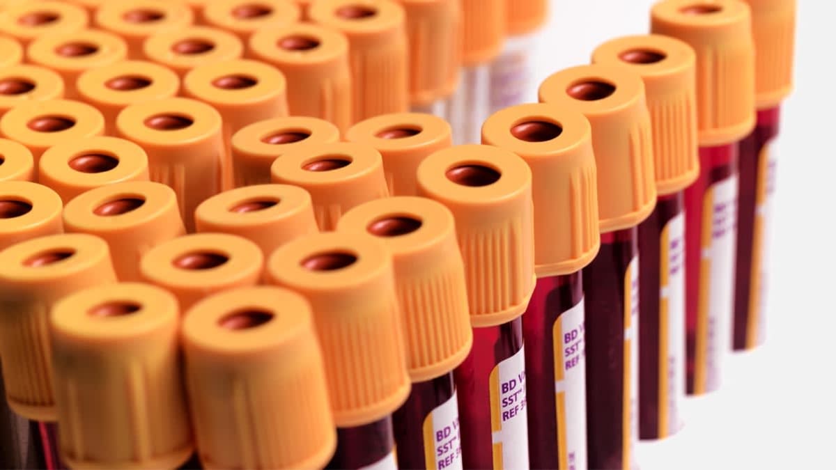 HIV test