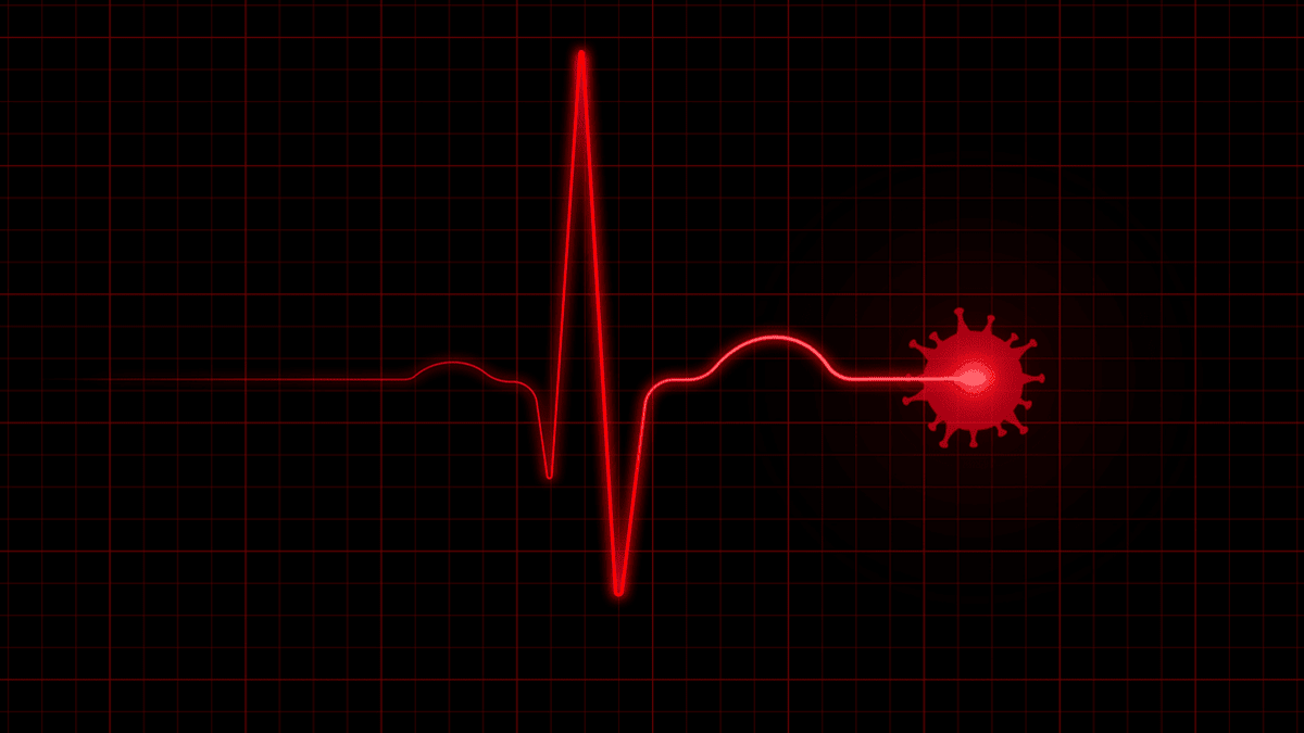 Illustration of an EKG monitor with a large blip in the shape of COVID-19.