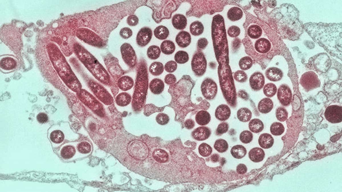 Legionella pneumophila bacteria