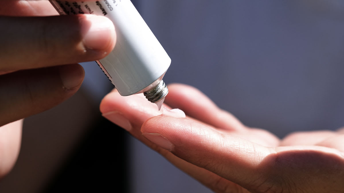 person applying steroid cream to finger