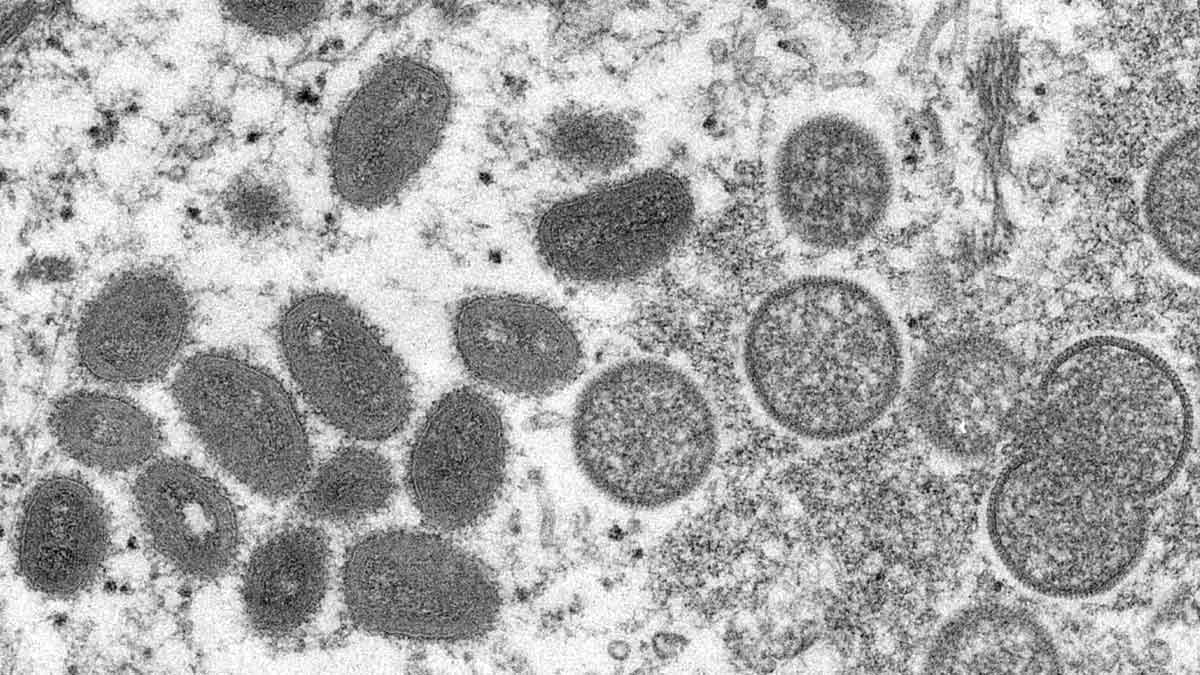money pox virus under a microscope
