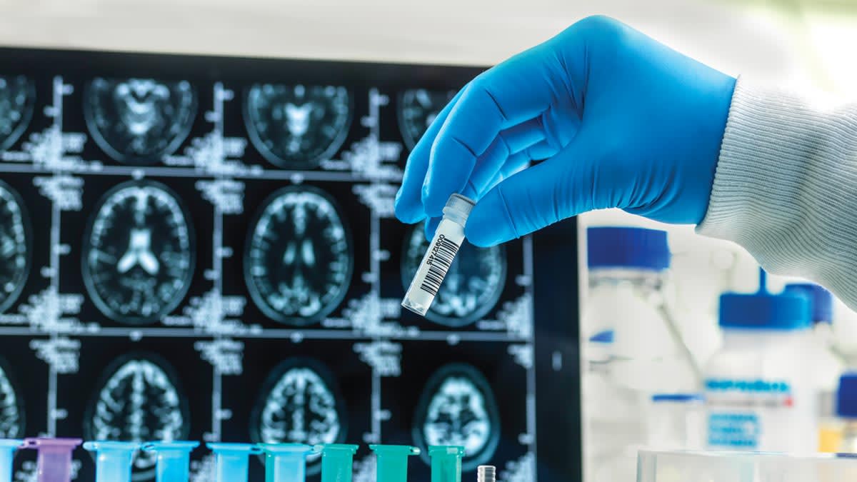 gloved hand holding vile with barcode and MRI scans on screen behind their hand