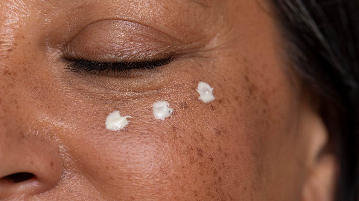 Closeup of a person's eye area with three dots of moisturizer under the eye.