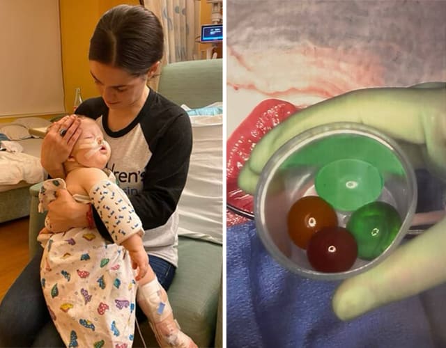 Deacon Nickols being transported by ambulance to Children's Wisconsin hospital in Milwaukee and being held by his mother, Haley, after several surgeries to remove water beads (in cup) that had lodged in his intestines.