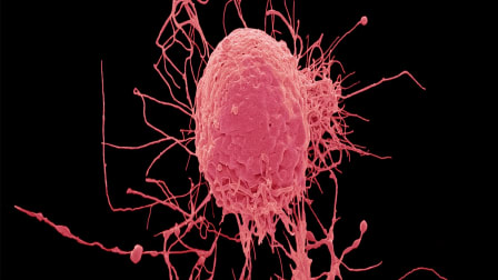 The Trouble With Stem Cell Therapy