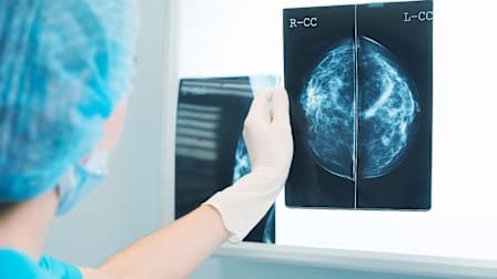 What Kind of Breast Cancer Screening Should You Get?