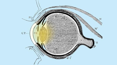 What You Should Know About Cataract Surgery