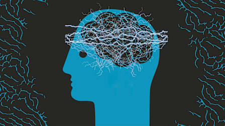 How to Find Migraine Relief Later in Life