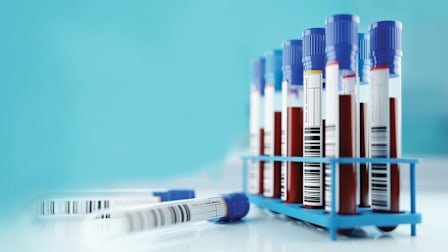 test tubes filled with blood in stand with 2 empty test tubes on surface