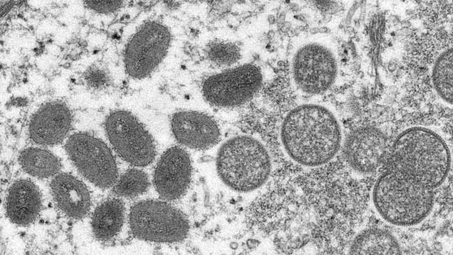 money pox virus under a microscope