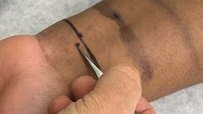 a tester placing tick on treated arm