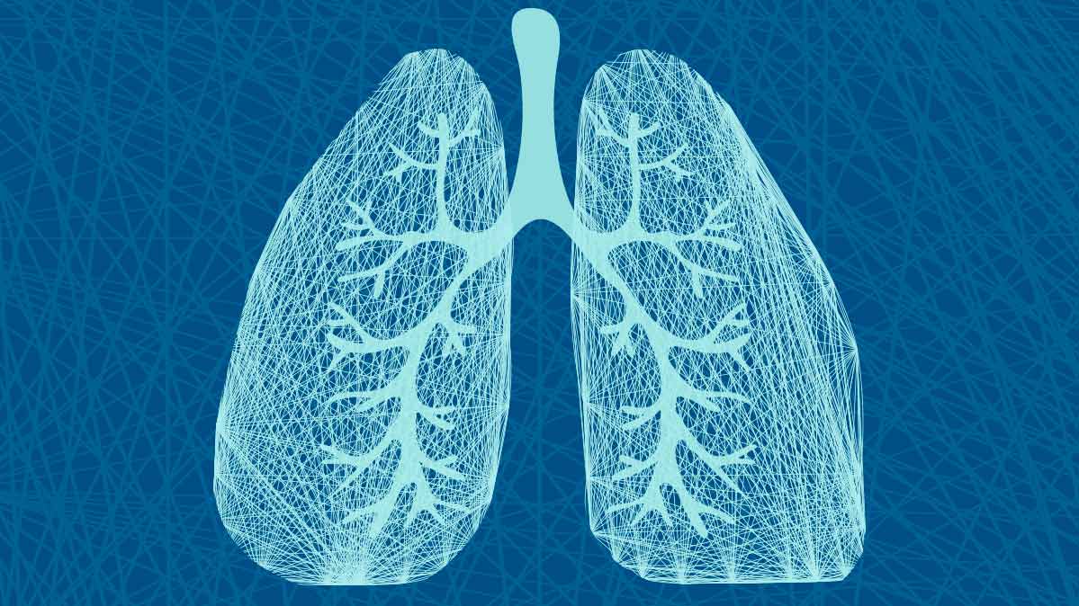 Should You Have a Lung Cancer Screening? - Consumer Reports