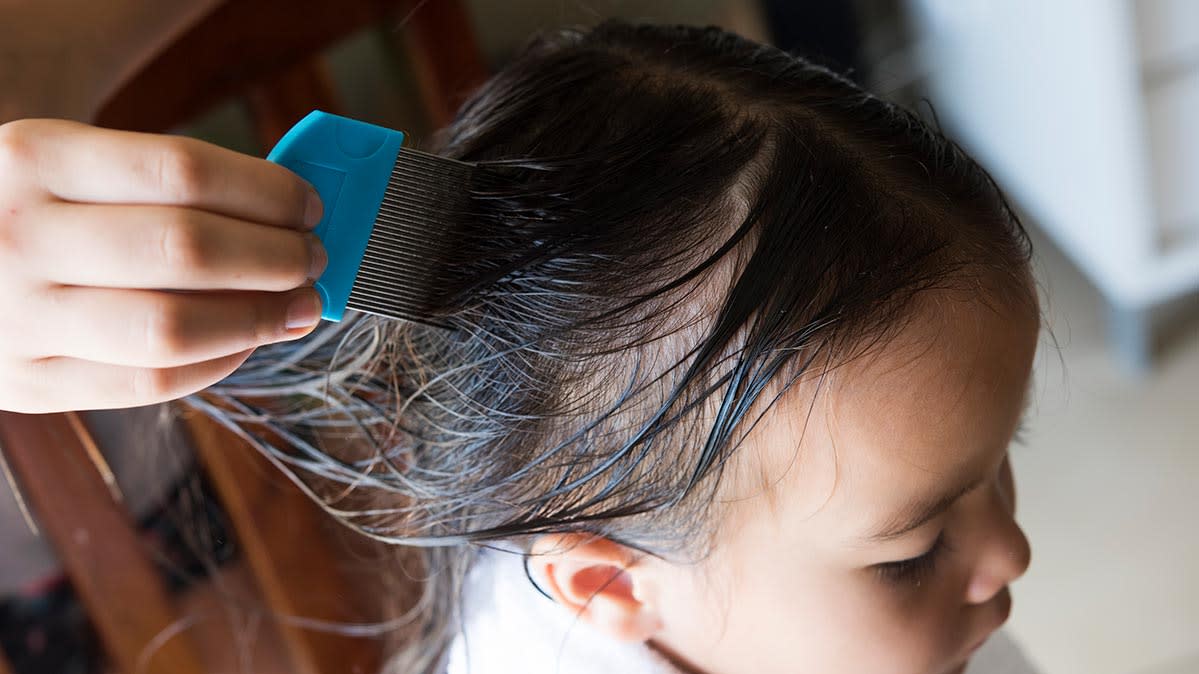 ÐÐ°ÑÑÐ¸Ð½ÐºÐ¸ Ð¿Ð¾ Ð·Ð°Ð¿ÑÐ¾ÑÑ comb against lice