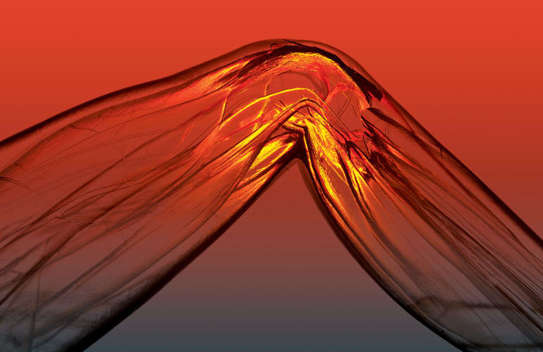 An illustration depicting knee pain.