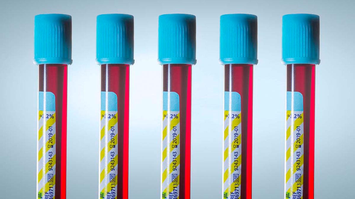 Why Theres Disagreement Over Screening >> Pros And Cons Of 18 Medical Tests Consumer Reports Why Theres Disagreement Over Screening >> Pros And Cons Of 18 Medical Tests Consumer Reports