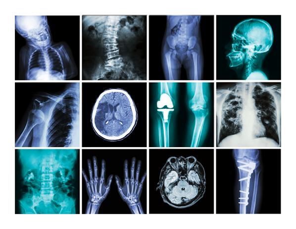 CRM_Page_36_X Ray_Collage_03 15