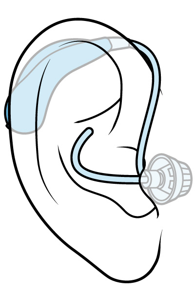 Illustration of a behind-the-ear hearing aid.