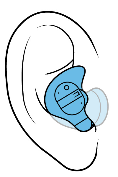 Illustration of an in-the-ear hearing aid.
