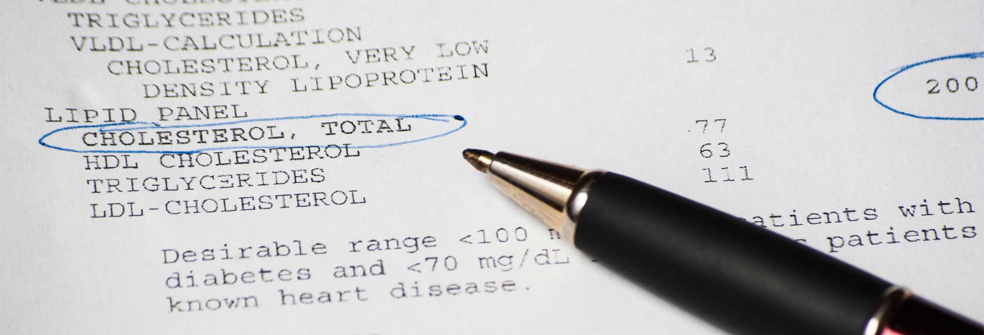 get-accurate-cholesterol-test-results-consumer-reports