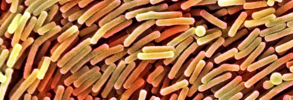 C. Diff: Deadly Infection on the Rise - Consumer Reports